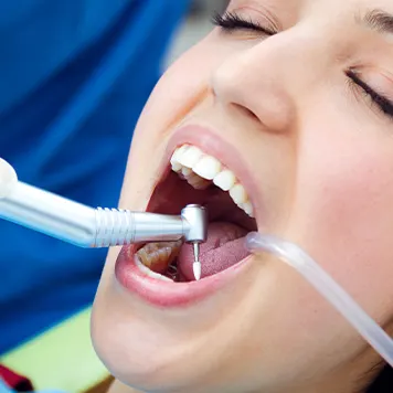Professional dental cleaning