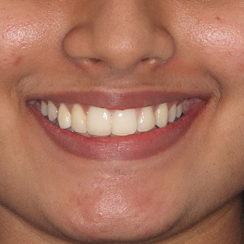 After - Ortho