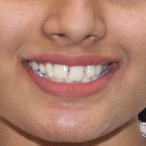 Before - Ortho